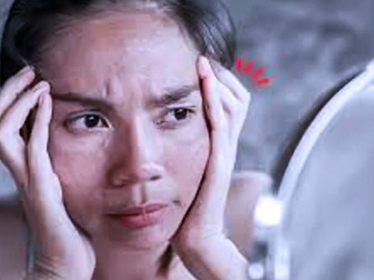 Alarm Dini Gaya Hidup dan Pergeseran Paradigma Estetika Kulit